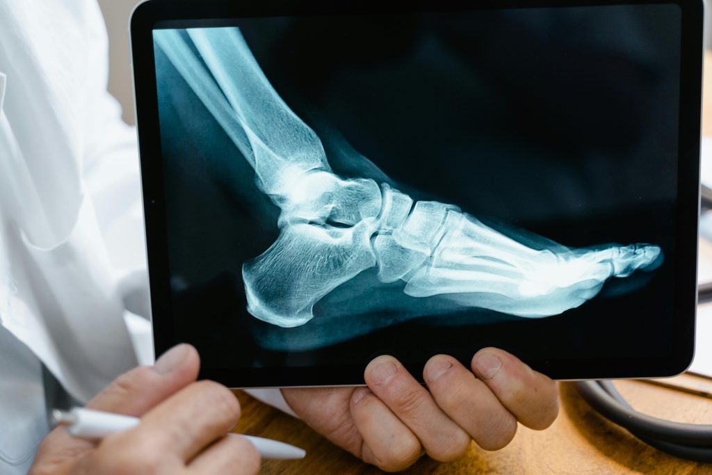 pexels photo 8376285 8376285 A doctor reviews a foot X-ray on a digital tablet in a medical consultation setting.